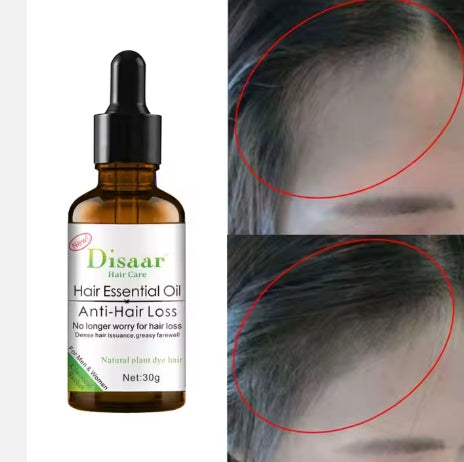 Sérum de croissance des cheveux - Pour Homme et Femme