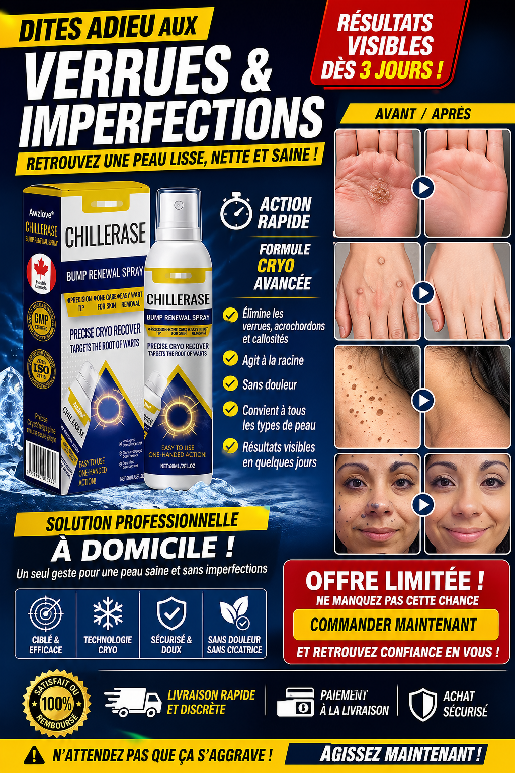 Le spray efficace pour éliminer verrues, callosités, boutons et imperfections