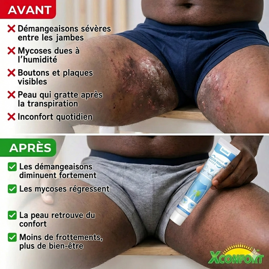 🔥 Offre Spéciale : Crèmes Anti-Démangeaisons & Antibactériennes