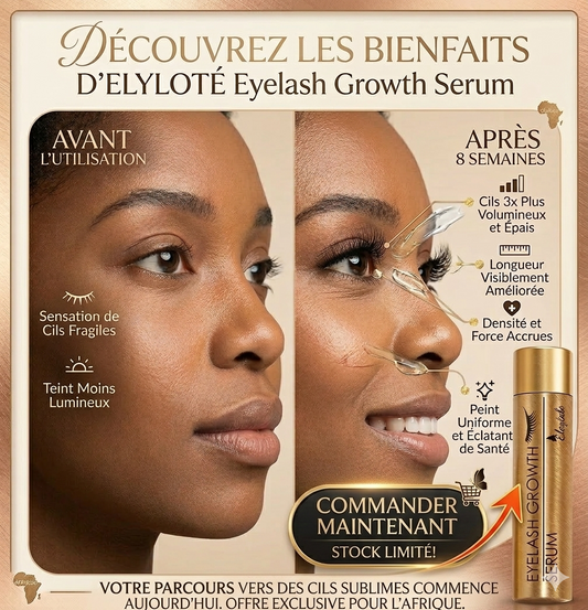 🌟 Des cils longs, épais et naturellement sublimes… Profitez dès maintenant de notre offre exceptionnelle : 9000 f ✨
