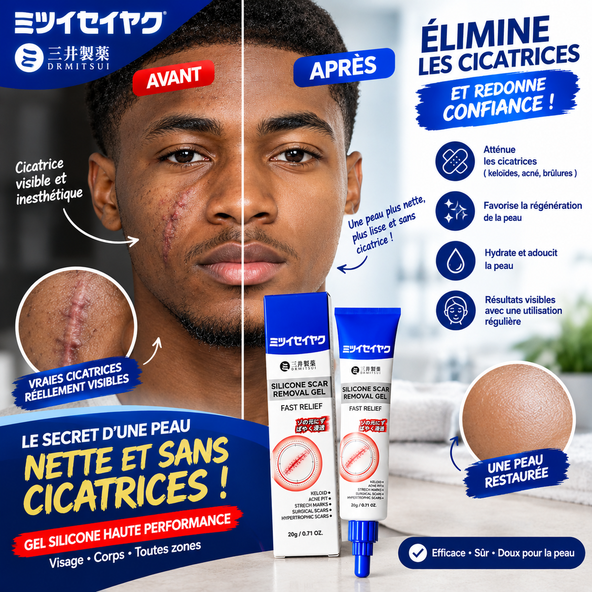 ✨ Gel Silicone Anti-Cicatrices – Pour une Peau Plus Lisse et Uniforme !