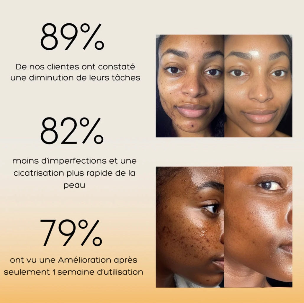Nettoyant visage au curcuma™️