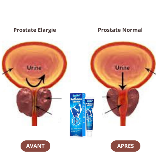 Crème Naturelle Anti-Prostate – Diminue l'inflammation, élimine les troubles urinaire, Renforce et Redonne Confiance aux Hommes