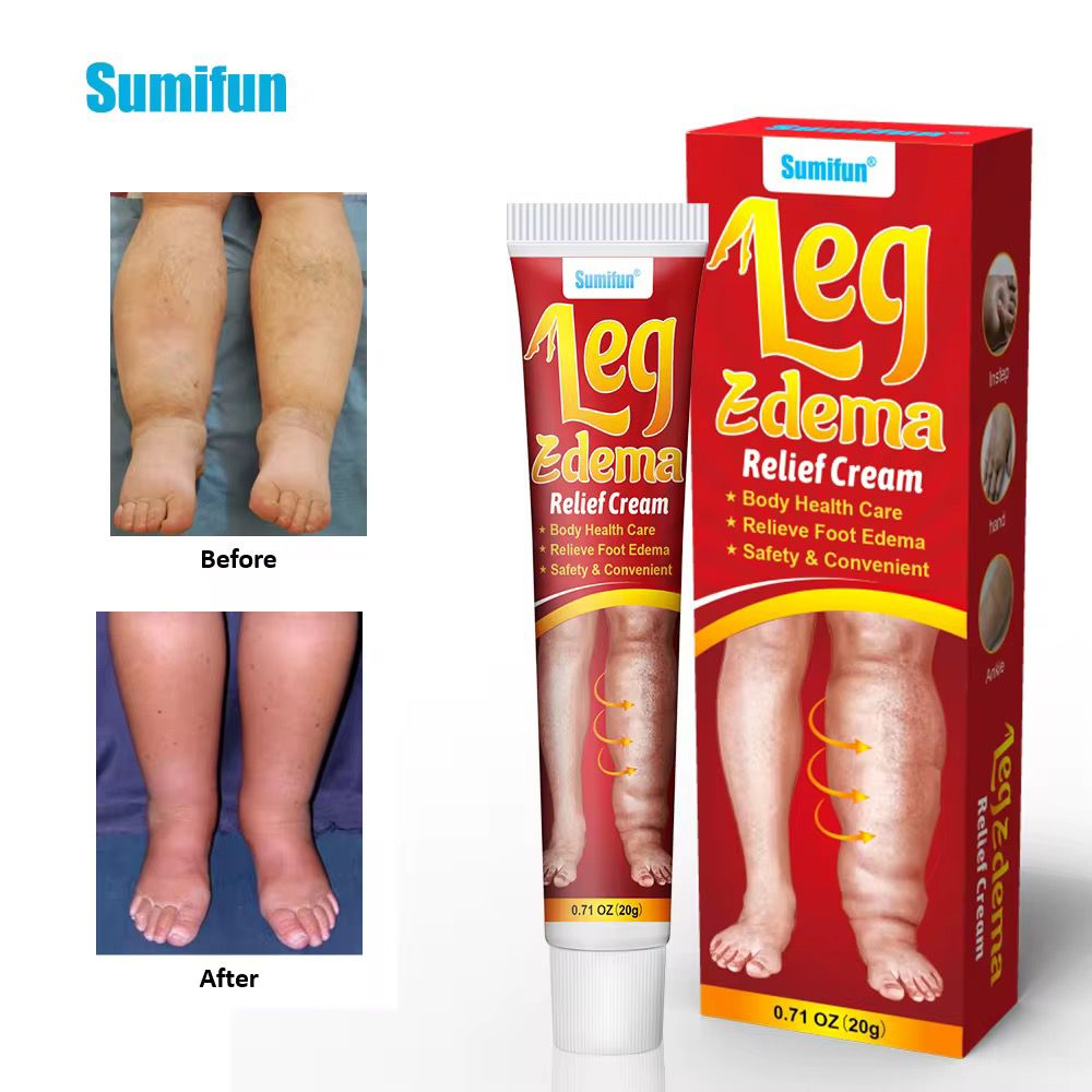 đ§Ž CrĂšme Anti-Gonflement des Jambes â Sumifun Leg Edema Relief Cream