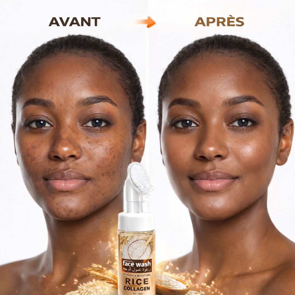 🔥 PEAU NETTE, ÉCLATANTE & SANS IMPERFECTIONS EN QUELQUES JOURS !