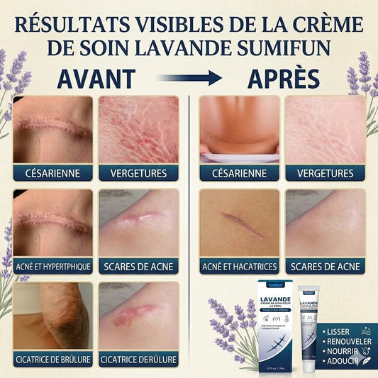 Crème Réparatrice à la Lavande – Solution Intensive Anti-Cicatrices & Vergetures