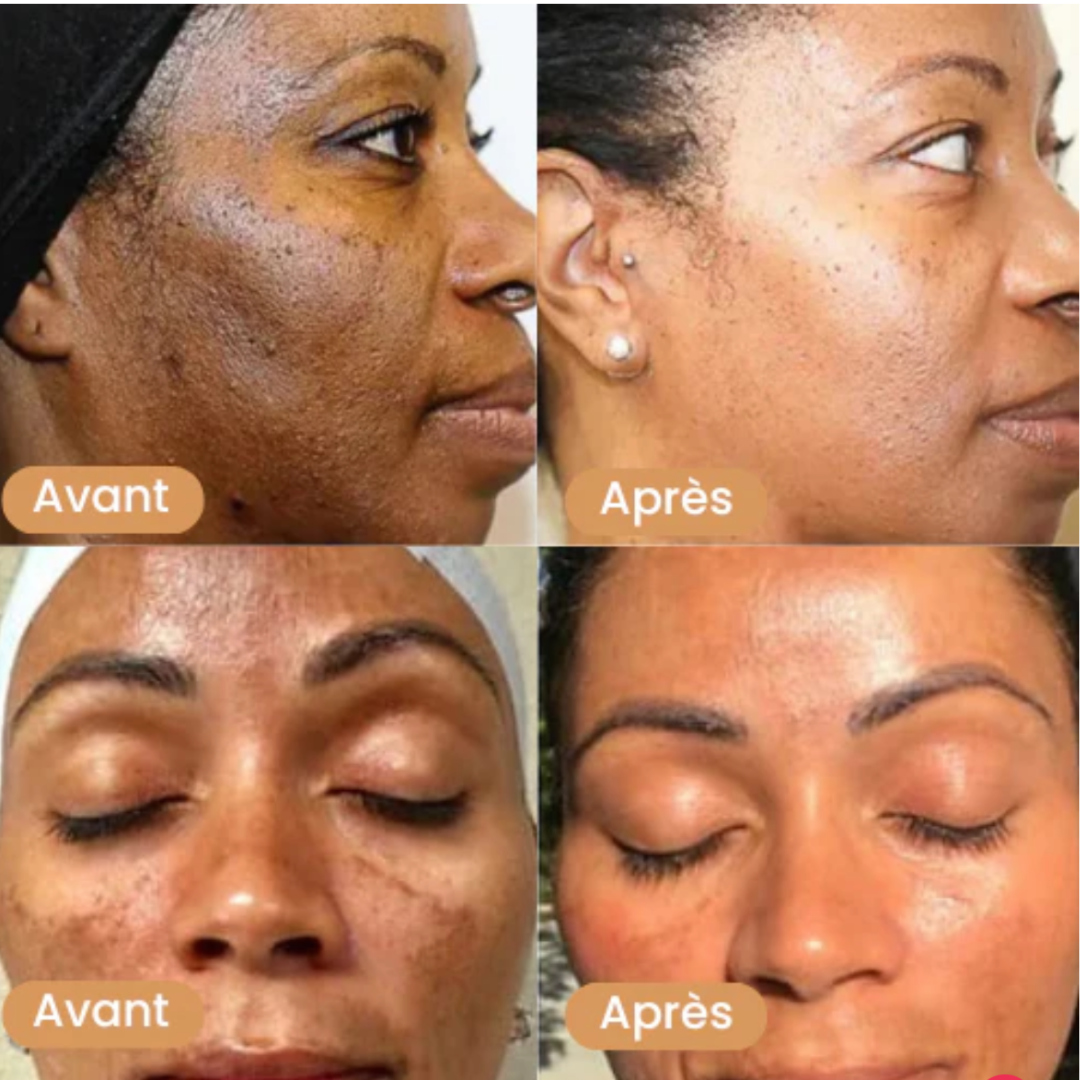 Nettoyant visage au curcuma™️
