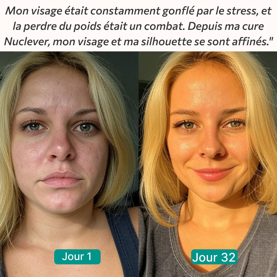 Nuclever Cortisol Manager (TT)