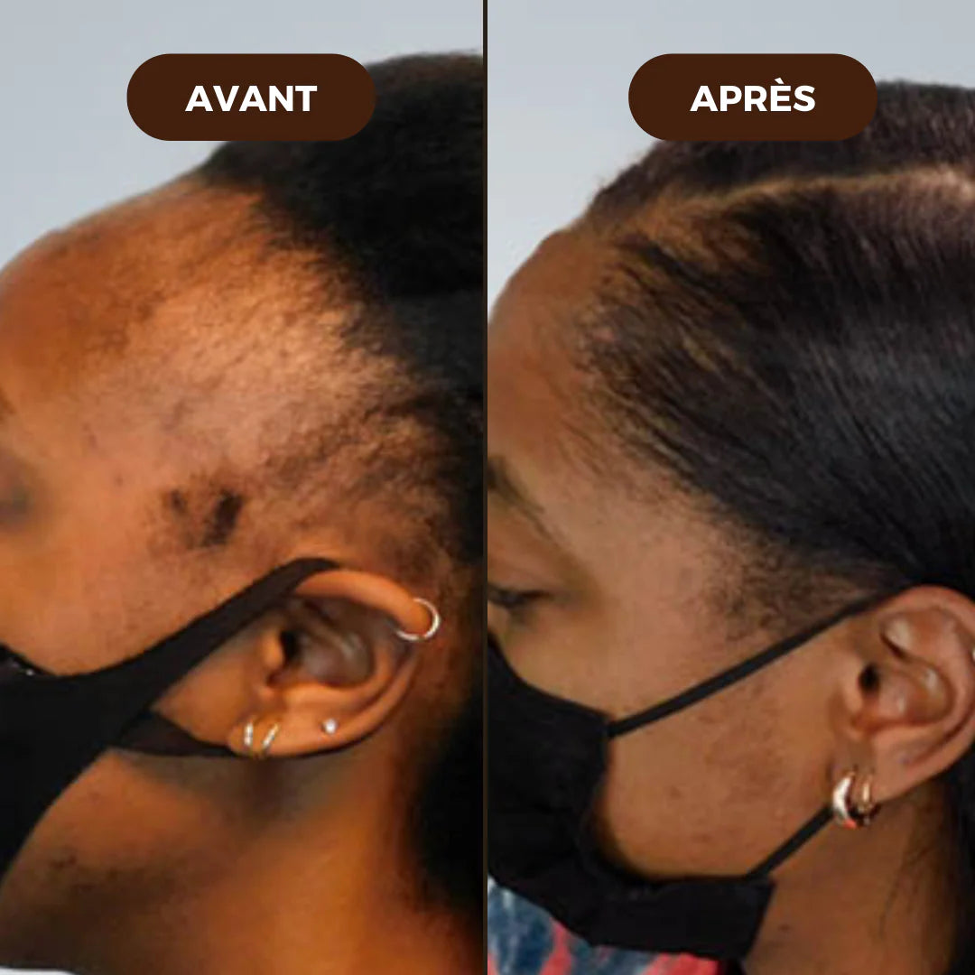 Sérum roll-on pour la croissance des cheveux