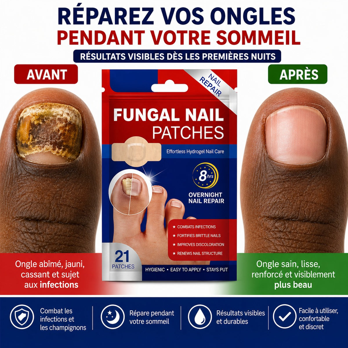Patch ongles / PureOngles™ : pour des Ongles Impeccables !