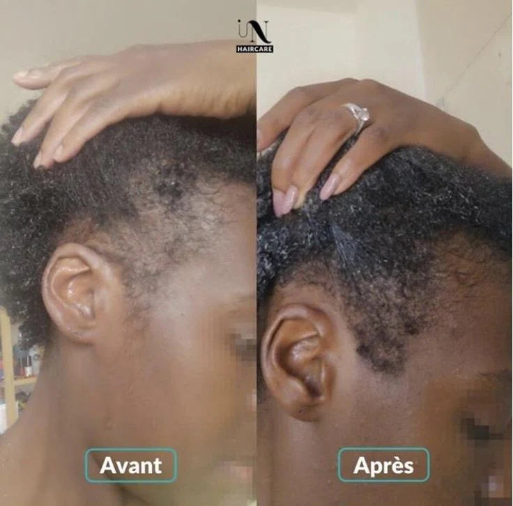 Sérum roll-on pour la croissance des cheveux