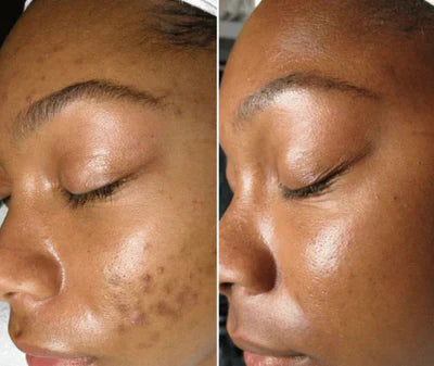 Nettoyant visage au curcuma™️