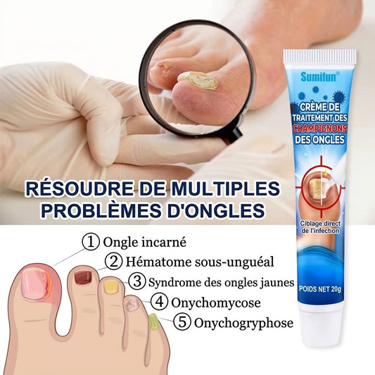 🔥 Dites Adieu aux Ongles Abîmés en Quelques Jours !
