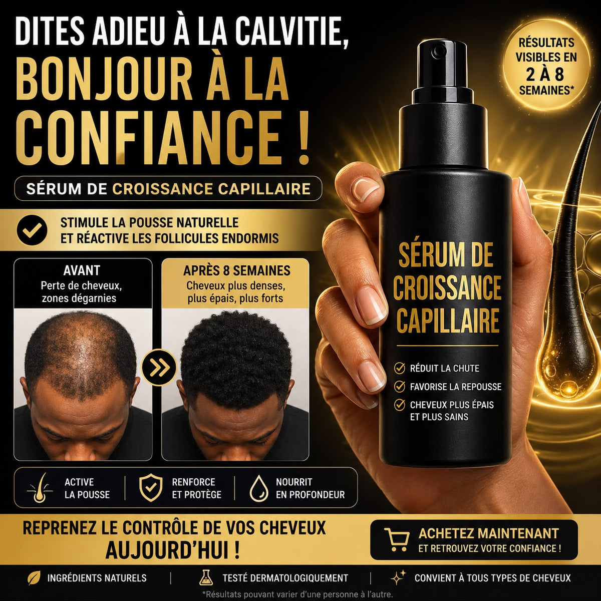 Spray Capillaire Anti-Calvitie – Stimule la Repousse et Redonne de la Densité