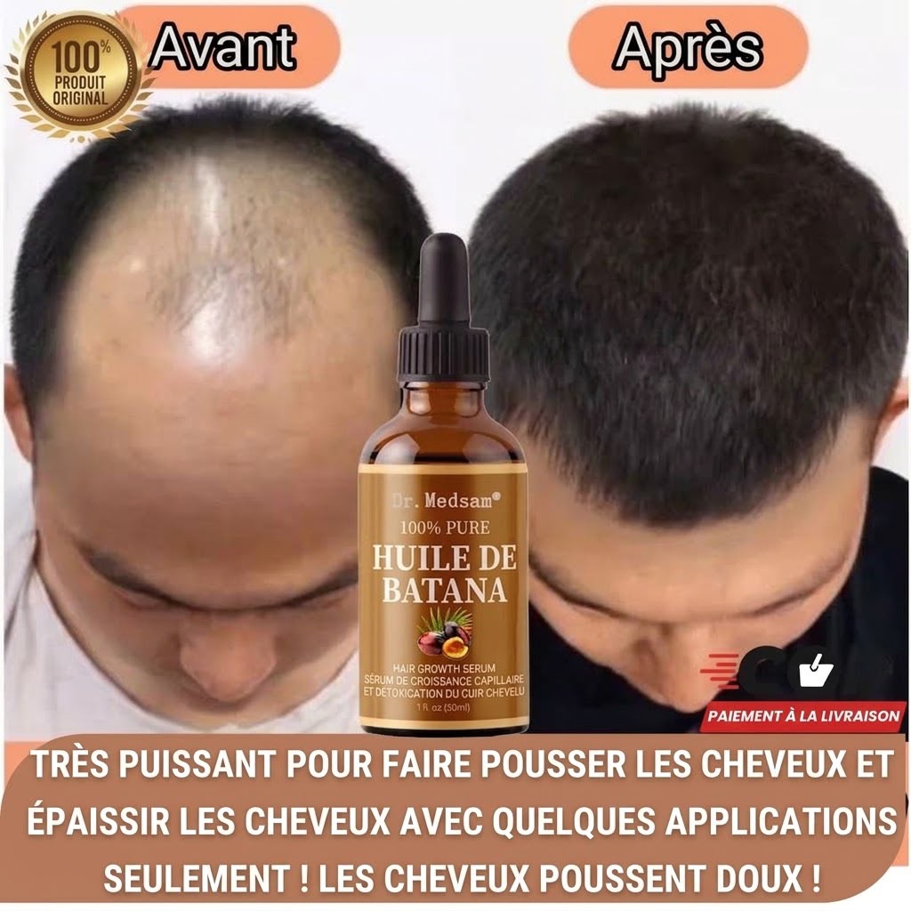 Huile de Batana & Romarin Pure – Élixir Repousse & Anti-Chute Intense (30ml)