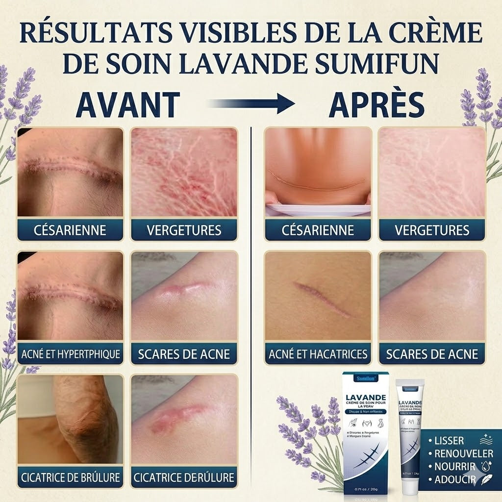 Crème Réparatrice à la Lavande – Solution Intensive Anti-Cicatrices & Vergetures