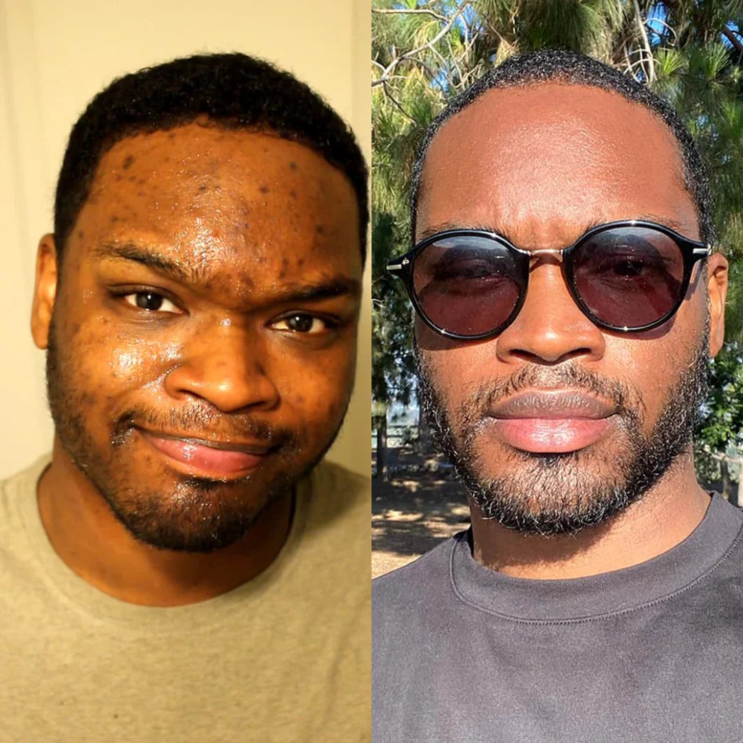 Nettoyant visage au curcuma™️