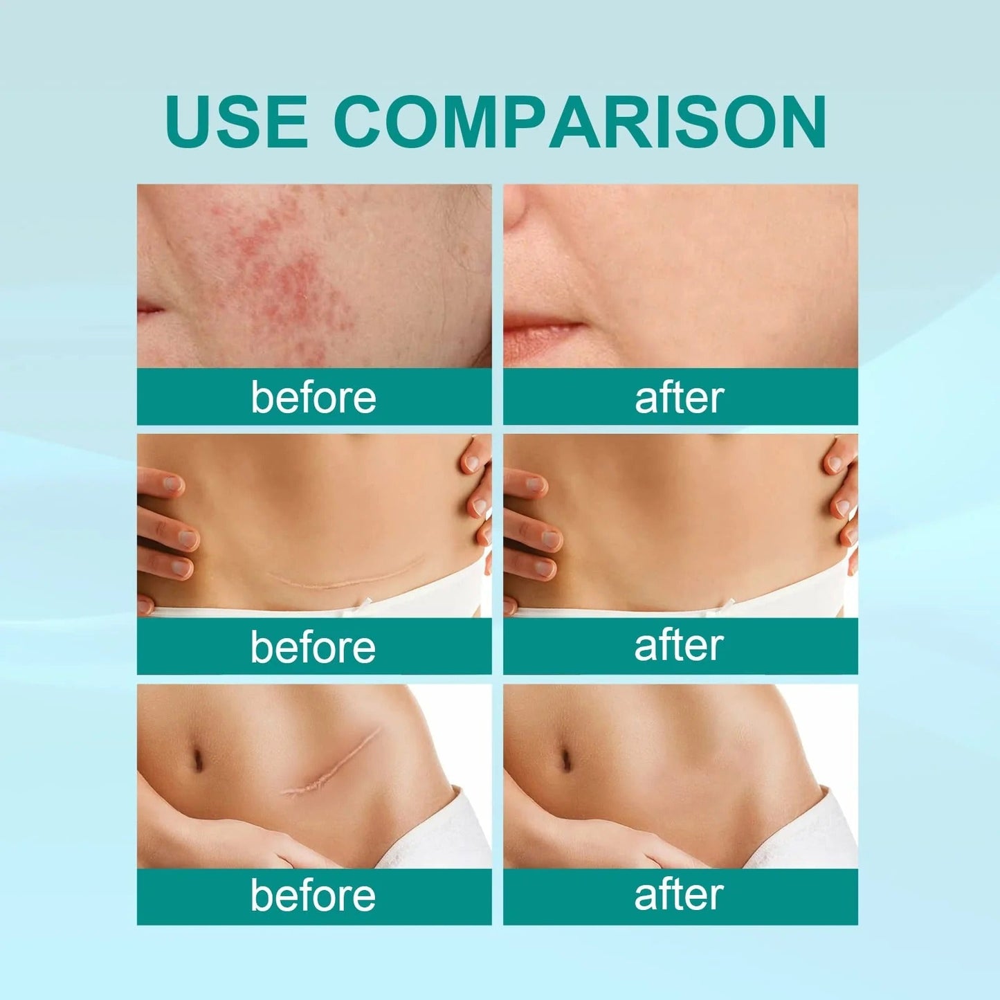 Scar Remove Spray